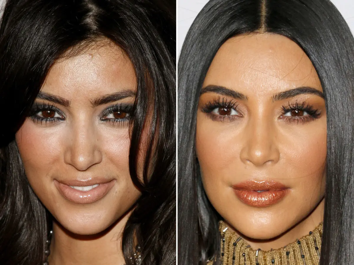 kim-kardashian-before-and-after