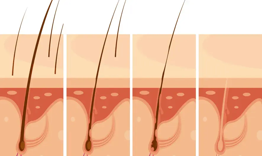 6298f1ecb970051f2a89051d_what-hair-graft-and-how-it-created (1)