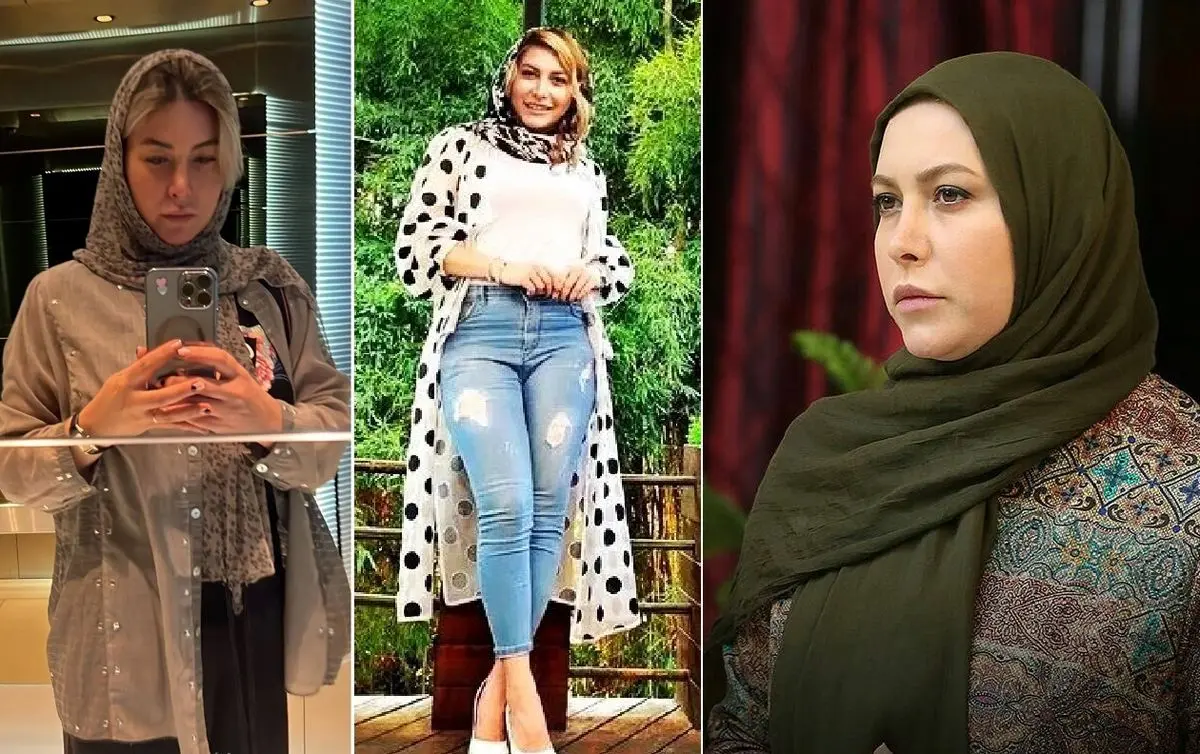 فریبا نادری قبل از عمل