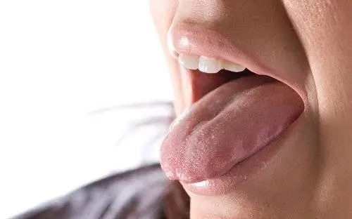 Dry-mouth