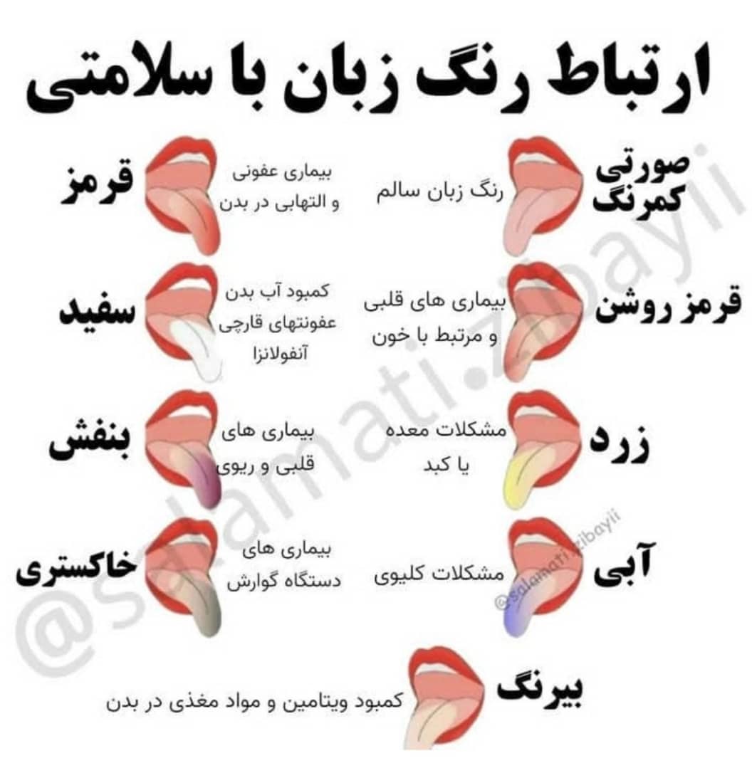 زبان+و+بیماری+ها