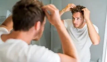 بهترین راه جلوگیری از ریزش مو در آقایان