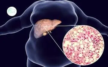 برای تقویت کبد این کار را بکنید!