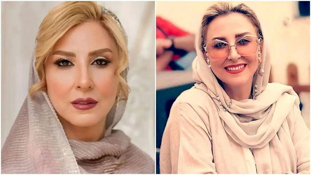 محبوب ترین جراحی های زیبایی بین سلبریتی های ایرانی