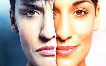 بدریخت انگاری؛ اختلالی که عامل 95 درصد جراحی های زیبایی است!