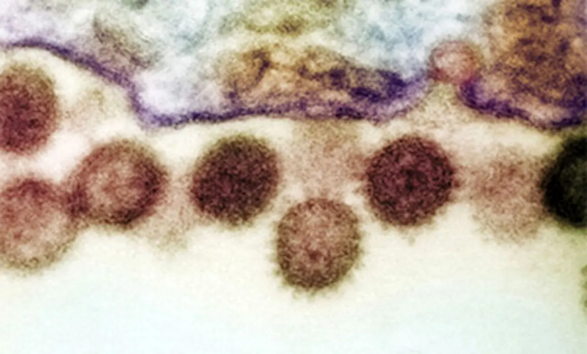 چند راه برای پیشگیری از تب کریمه کنگو
