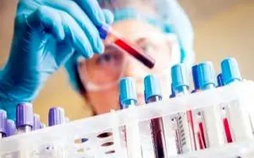 خطر انتقال ایدز و هپاتیت با استفاده از برس مشترک مو