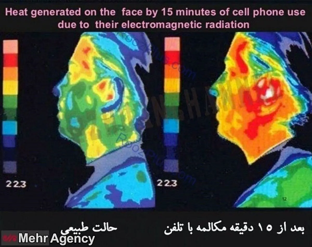یک ربع استفاده از تلفن همراه با صورت شما چه می کند ؟+ عکس