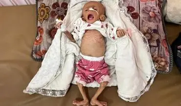 ادامه فاجعه انسانی در نوار غزه؛ نوزاد ۶ ماهه فلسطینی از گرسنگی جان باخت