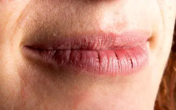 5 راهکار طلایی برای جلوگیری از خشکی و ترک خوردن لب‌ها در پاییز