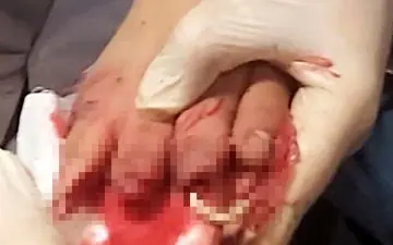 بلعیده شدن انگشتان دختر 12 ساله دهدشتی در آبمیوه گیری+عکس دلخراش 