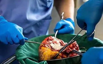  بیجار در ماتم/فداکاری محمدرضا معصوم‌خانی در بیمارستان 