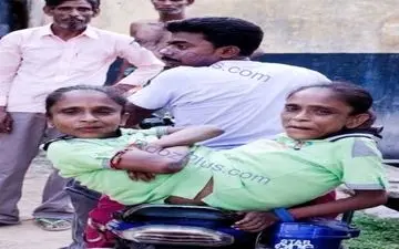 ازدواج باورنگردنی خواهران از شکم بهم چسبیده با یک مرد! +عکس