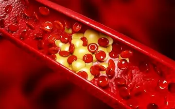  غذاهای با مزاج سرد نخورید|  بهترین سبزی برای کاهش چربی خون