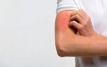 این حال و روز بد، از زیادی رقیق بودن خون شماست