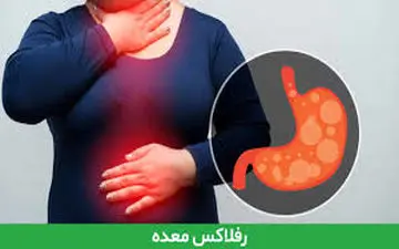 شاید باورتان نشود رفلاکس اسید معده این بلا را بر سر شما می آورد!
