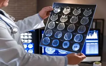 چرا شتاب پیری مغز در افراد مختلف متفاوت است؟
