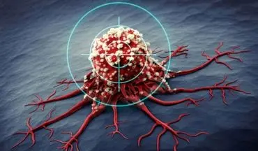 آیا می دانید این نوع عادات خواب در مردان احتمال ریسک ابتلا به سرطان را افزایش می دهد؟