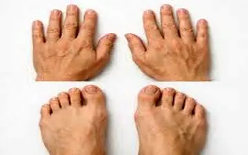 علت نامتقارن بودن بدن ما چیست؟