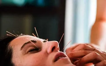 طب سوزنی صورت چگونه باعث جوان‌سازی پوست می‌شود؟