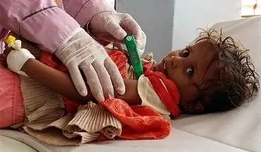 وضعیت اسفبار کودکان یمنی/دو میلیون کودک در یمن از سوء تغذیه حاد رنج می‌برند 
