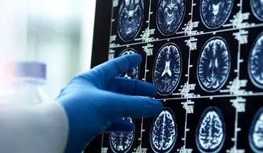 چهار نقطه عطف در تغییرات مغزی انسان: از ۹ سالگی تا ۸۳ سالگی/ مغز انسان تا ۳۲ سالگی «بالغ» نمی‌شود