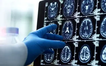 چهار نقطه عطف در تغییرات مغزی انسان: از ۹ سالگی تا ۸۳ سالگی/ مغز انسان تا ۳۲ سالگی «بالغ» نمی‌شود