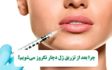 چرا بعد از تزریق ژل نکروز رخ می دهد؟

