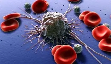  روش جدید شناسایی سلول سرطانی!