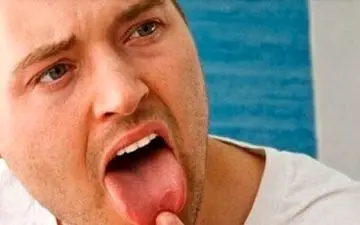 داروهایی که حس چشایی شما را تغییر می دهند

