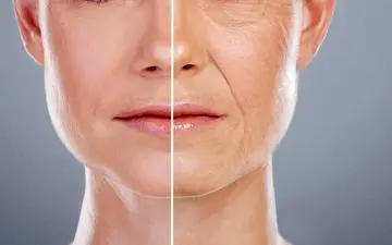 روتین‌های تیک‌تاکی بلای جان پوست جوانان