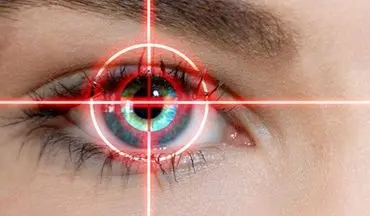 بهترین سن برای عمل لیزیک چشم