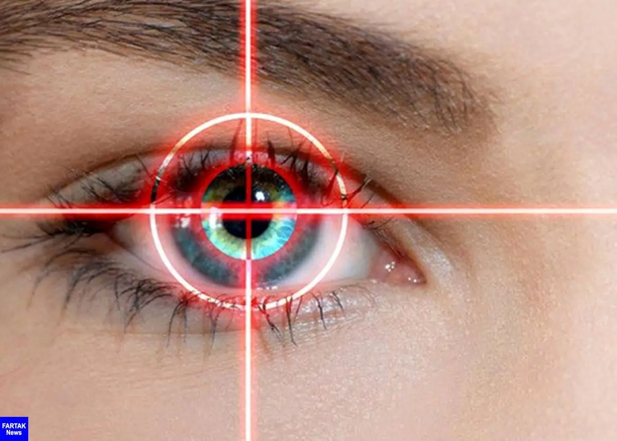 بهترین سن برای عمل لیزیک چشم