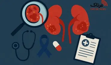هر آنچه باید درباره سرطان کلیه بدانید؛ بیماری خاموش اما خطرناک