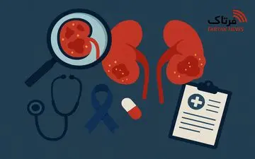 هر آنچه باید درباره سرطان کلیه بدانید؛ بیماری خاموش اما خطرناک