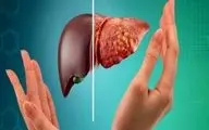 این عوامل به کبد آسیب می زنند!