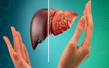 این عوامل به کبد آسیب می زنند!