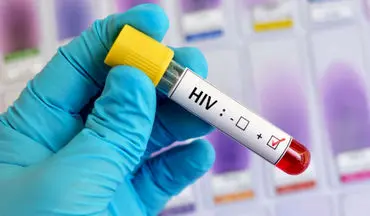 HIV چگونه منتقل می‌شود؟ 