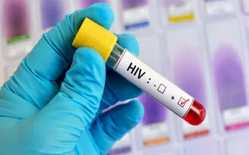 HIV چگونه منتقل می‌شود؟ 