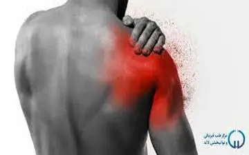 علت درد شدید و ناگهانی شانه چیست؟| علت و درمان درد شانه