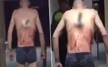 اقدام عجیب یک بیمار هنگام عمل جراحی! +فیلم 