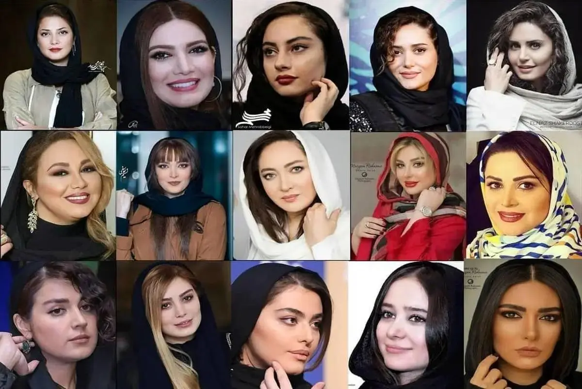 چهرههای جدید بازیگران زن ایرانی با جراحی زیبایی! + تصاویر
