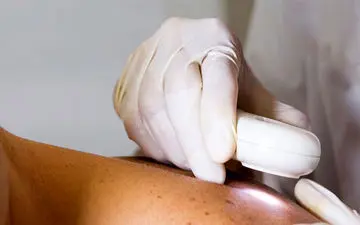 علائم اولیه سرطان پوست که نباید نادیده بگیرید!