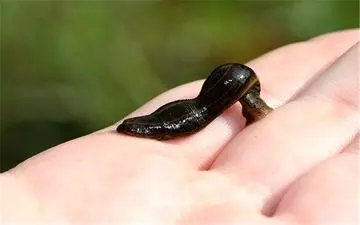 آیا از "زالودرمانی" می‌توان برای درمان بیماری‌های مختلف استفاده کرد؟! 