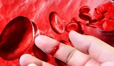 با بیماری هموفیلی بیشتر آشنا شوید