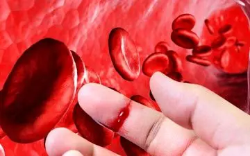 با بیماری هموفیلی بیشتر آشنا شوید