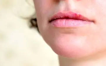 شایع‌ترین و خطرناک‌ترین بیماری های لب