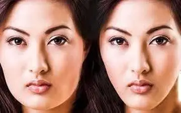 اگر به دنبال راهی برای چاقی صورت هستید این مطلب را بخوانید!