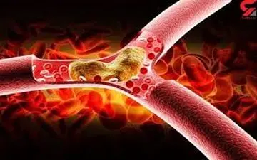 مواد غذایی مضر برای چربی خون بالا