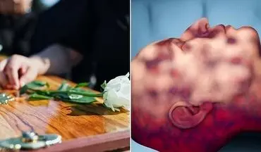 گزارشی از یک فرآیند ترسناک/ فروپاشی بدن انسان پس از مرگ چگونه است؟